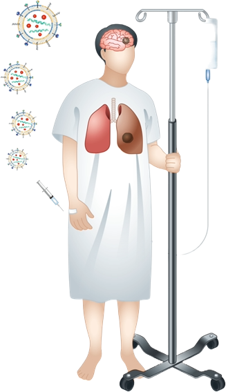 환자 맞춤형 복합 종양 표적 엑토-리포좀 약물
