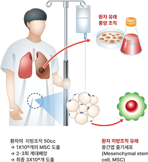 폐종양 및 줄기세포 일차배양